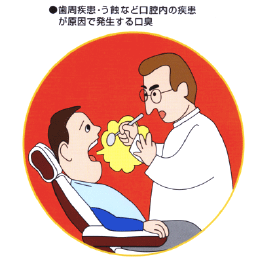 歯周疾患、う蝕など口腔内の疾患が原因で発生する口臭です。